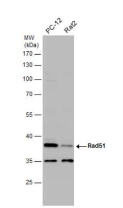 Rad51 Antibody, Novus Biologicals 0.1mL; Unlabeled:Antibodies, Polyclonal
