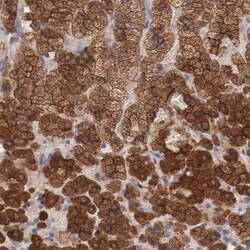 Radixin Antibody, Novus Biologicals 0.1 mL | Buy Online | Novus Biologicals | Fisher Scientific
