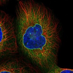RanGAP1 Antibody, Novus Biologicals 0.1mL; Unlabeled:Antibodies, Polyclonal