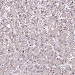 RanGAP1 Antibody, Novus Biologicals 0.1mL; Unlabeled:Antibodies, Polyclonal