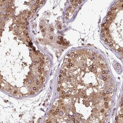 RanGAP1 Antibody, Novus Biologicals 0.1mL; Unlabeled:Antibodies, Polyclonal