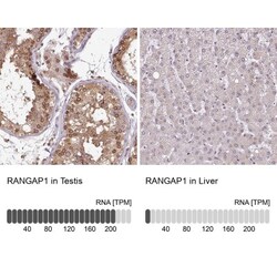 RanGAP1 Antibody, Novus Biologicals 0.1mL; Unlabeled:Antibodies, Polyclonal