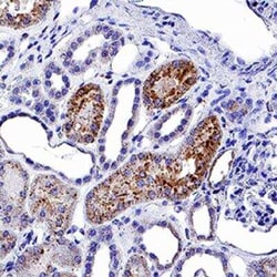 Novus Biologicals Rapid DAB Staining Kit (Colorimetric) 100 Tests | Buy Online | Novus Biologicals&trade; | Fisher Scientific