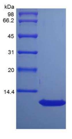 Novus Biologicals Recombinant Rat CCL17/TARC Protein 5 &mu;g | Buy Online | Novus Biologicals&trade; | Fisher Scientific