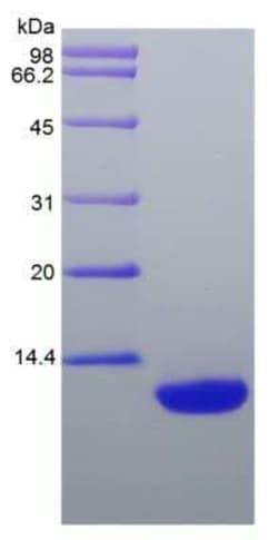 Novus Biologicals&trade;&nbsp;Recombinant Rat CCL22/MDC Protein