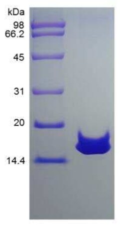 Novus Biologicals Recombinant Rat CCL28 Protein 5 &mu;g | Buy Online | Novus Biologicals&trade; | Fisher Scientific
