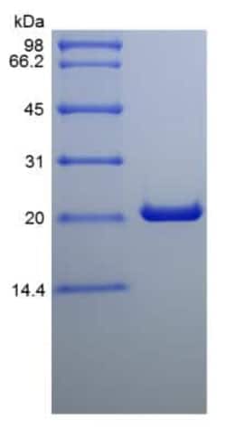 Novus Biologicals&trade;&nbsp;Recombinant Rat Cardiotrophin-1/CT-1 Protein