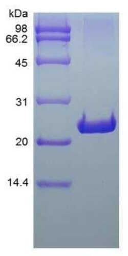Novus Biologicals Recombinant Rat FGF-9 Protein 100 &mu;g | Buy Online | Novus Biologicals&trade; | Fisher Scientific