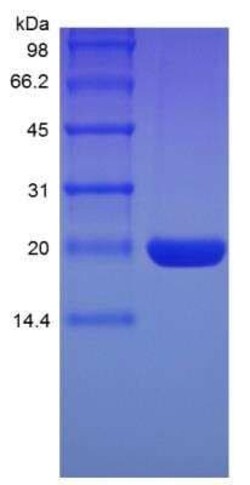 Novus Biologicals Recombinant Rat G-CSF Protein 500 &mu;g | Buy Online | Novus Biologicals&trade; | Fisher Scientific