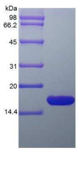 Novus Biologicals Recombinant Rat GMF-beta Protein 500 &mu;g | Buy Online | Novus Biologicals&trade; | Fisher Scientific