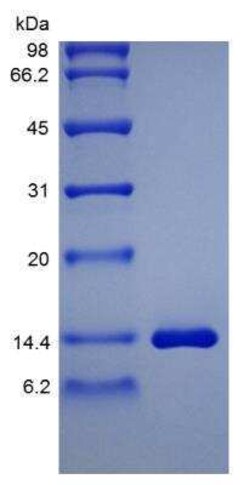 Novus Biologicals Recombinant Rat HB-EGF Protein 100 &mu;g | Buy Online | Novus Biologicals&trade; | Fisher Scientific