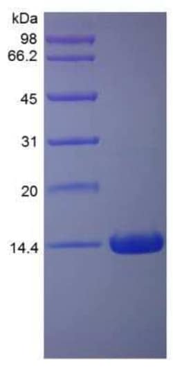 Novus Biologicals Recombinant Rat IFN-gamma Protein 100 &mu;g | Buy Online | Novus Biologicals&trade; | Fisher Scientific