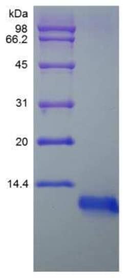 Novus Biologicals Recombinant Rat IGF-I/IGF-1 Protein 1mg | Buy Online | Novus Biologicals&trade; | Fisher Scientific
