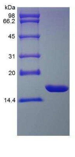 Novus Biologicals Recombinant Rat IL-1 alpha/IL-1F1 Protein 100 &mu;g | Buy Online | Novus Biologicals&trade; | Fisher Scientific