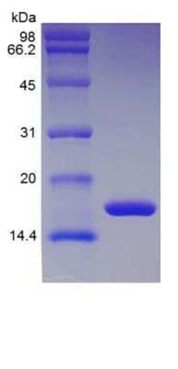 Novus Biologicals Recombinant Rat IL-1 beta/IL-1F2 Protein 1 mg | Buy Online | Novus Biologicals&trade; | Fisher Scientific