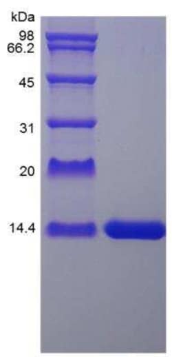 Novus Biologicals Recombinant Rat IL-2 Protein 1 mg | Buy Online | Novus Biologicals&trade; | Fisher Scientific
