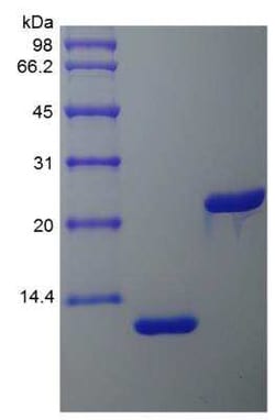 Novus Biologicals Recombinant Rat IL-5 Protein 1 mg | Buy Online | Novus Biologicals&trade; | Fisher Scientific