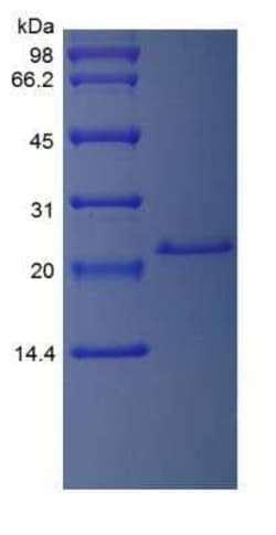 Novus Biologicals Recombinant Rat IL-6 Protein 10 &mu;g | Buy Online | Novus Biologicals&trade; | Fisher Scientific