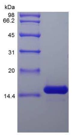 Novus Biologicals Recombinant Rat IL-7 Protein 100 &mu;g | Buy Online | Novus Biologicals&trade; | Fisher Scientific