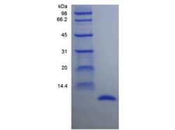 Novus Biologicals Recombinant Rat MIF Protein 100 &mu;g | Buy Online | Novus Biologicals&trade; | Fisher Scientific