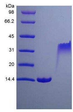 Novus Biologicals Recombinant Rat PDGF-BB Protein 10 &mu;g | Buy Online | Novus Biologicals&trade; | Fisher Scientific