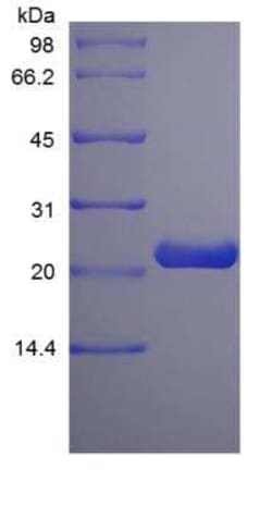 Novus Biologicals Recombinant Rat Prolactin Protein 100 &mu;g | Buy Online | Novus Biologicals&trade; | Fisher Scientific
