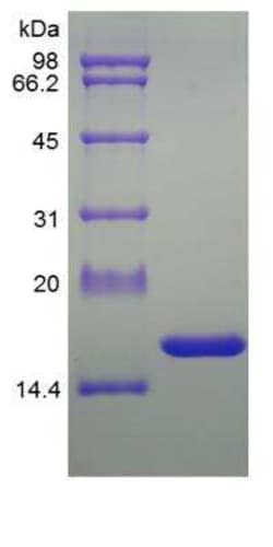 Novus Biologicals Recombinant Rat TNF-alpha Protein 1 mg | Buy Online | Novus Biologicals&trade; | Fisher Scientific