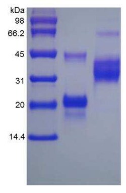 Novus Biologicals Recombinant Rat VEGF 164 Protein 10 &mu;g | Buy Online | Novus Biologicals&trade; | Fisher Scientific