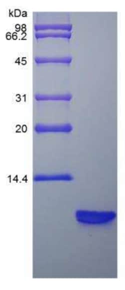 Novus Biologicals Recombinant Rat beta-Defensin 3 Protein 5 &mu;g | Buy Online | Novus Biologicals&trade; | Fisher Scientific