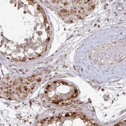 RbBP5 Antibody, Novus Biologicals 25 &mu;L, Unlabeled:Antibodies, Polyclonal