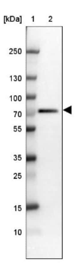 RbBP5 Antibody, Novus Biologicals 25 &mu;L, Unlabeled:Antibodies, Polyclonal