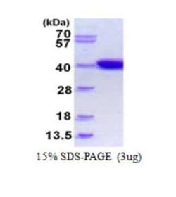 Novus Biologicals Recombinant E. coli IdHA His Protein 0.5 mg | Buy Online | Novus Biologicals&trade; | Fisher Scientific