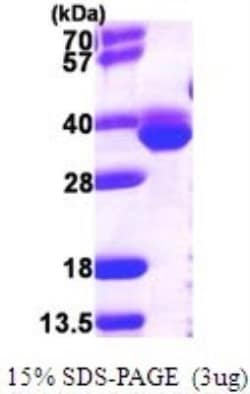 Novus Biologicals&trade;&nbsp;Recombinant Bacterial Methionine Aminopeptidase 1/METAP1 Protein
