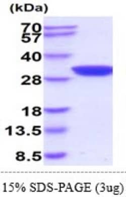 Novus Biologicals Recombinant Mouse AK2 Protein 20 &mu;g | Buy Online | Novus Biologicals&trade; | Fisher Scientific