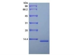Novus Biologicals Recombinant Mouse MIF Protein 100 &mu;g | Buy Online | Novus Biologicals&trade; | Fisher Scientific