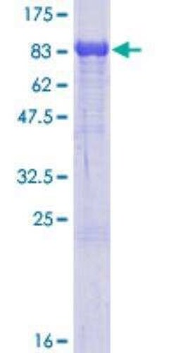 Novus Biologicals Recombinant Human 15-Lipoxygenase 2 GST (N-Term) Protein 25 &mu;g | Buy Online | Novus Biologicals&trade; | Fisher Scientific