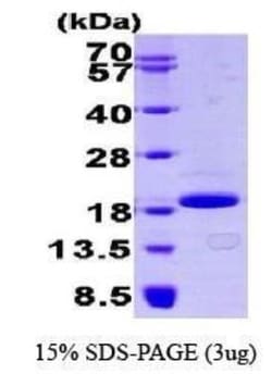 Novus Biologicals Recombinant Human 4EBP1 His Protein 0.1mg | Buy Online | Novus Biologicals&trade; | Fisher Scientific
