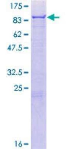 Novus Biologicals Recombinant Human 5-Lipoxygenase GST (N-Term) Protein 10 &mu;g | Buy Online | Novus Biologicals&trade; | Fisher Scientific