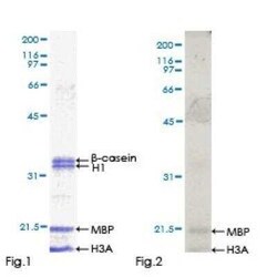 Novus Biologicals Recombinant Human A-RAF GST (N-Term) Protein 2 &mu;g | Buy Online | Novus Biologicals&trade; | Fisher Scientific