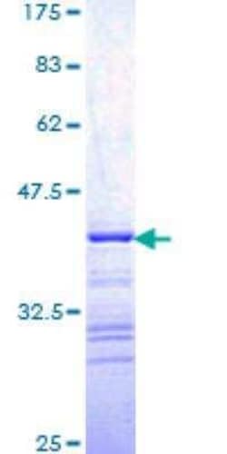 Novus Biologicals Recombinant Human A-RAF GST (N-Term) Protein 25 &mu;g | Buy Online | Novus Biologicals&trade; | Fisher Scientific