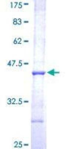 Novus Biologicals Recombinant Human AADAC GST (N-Term) Protein 10 &mu;g | Buy Online | Novus Biologicals&trade; | Fisher Scientific