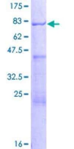 Novus Biologicals™ Recombinant Human AAMP GST (N-Term) Protein