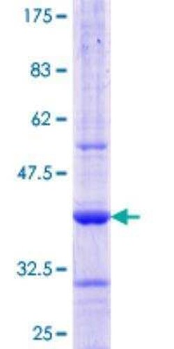 Novus Biologicals Recombinant Human AAMP GST (N-Term) Protein 25 &mu;g | Buy Online | Novus Biologicals&trade; | Fisher Scientific