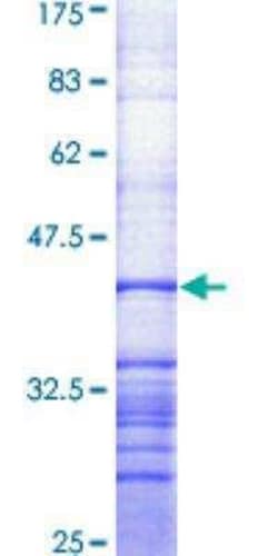 Novus Biologicals Recombinant Human ABCA1 GST (N-Term) Protein 10 &mu;g | Buy Online | Novus Biologicals&trade; | Fisher Scientific