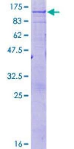 Novus Biologicals Recombinant Human ABCD1 GST (N-Term) Protein 25 &mu;g | Buy Online | Novus Biologicals&trade; | Fisher Scientific