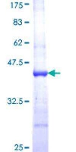 Novus Biologicals Recombinant Human ABCF1 GST (N-Term) Protein 25 &mu;g | Buy Online | Novus Biologicals&trade; | Fisher Scientific
