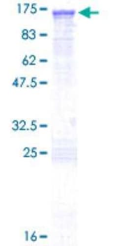 Novus Biologicals&trade;&nbsp;Recombinant Human ABR GST (N-Term) Protein