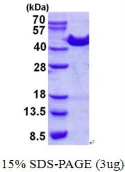 Novus Biologicals Recombinant Human ACAT1 His Protein 0.1 mg | Buy Online | Novus Biologicals&trade; | Fisher Scientific