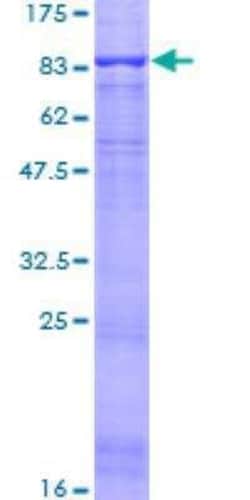 Novus Biologicals Recombinant Human ACCN2 GST (N-Term) Protein 25 &mu;g | Buy Online | Novus Biologicals&trade; | Fisher Scientific