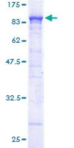 Novus Biologicals Recombinant Human ACOX1 GST (N-Term) Protein 10 &mu;g | Buy Online | Novus Biologicals&trade; | Fisher Scientific